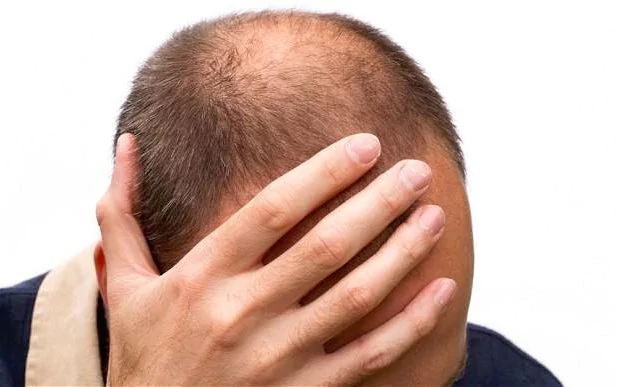 bald_2526587b-xlarge_transpjliwavx4cowfcaekesb3kvxit-lggwcwqwla_rxju8